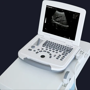 SoyMed doppler ultrazvukové postupnej pole chyba detektora lekárske vyšetrenia ultrazvukom nástrojov